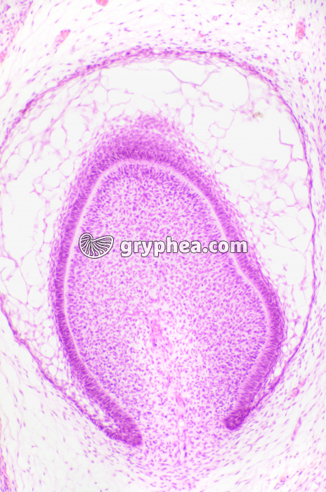 Germe dentaire CL x40 - gryphea.org
